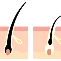 body_hair_mousyuuki-200x200